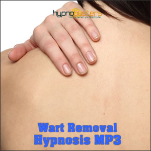 Wart Removal Hypnosis MP3